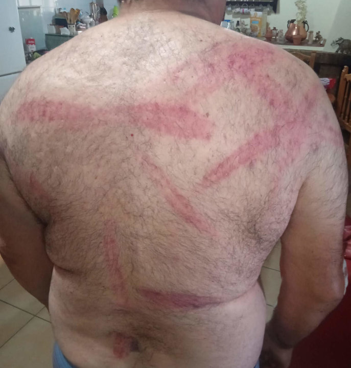 Imagen de la espalda del guarda tras la agresión con el bate de beisbol