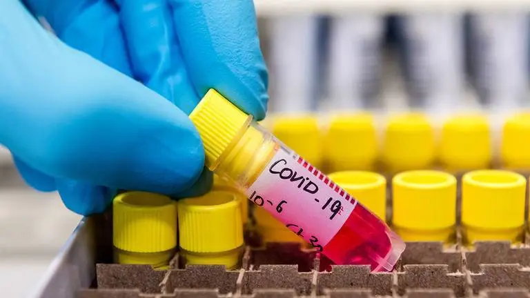 A laboratory worker places a test tube containing a patient's sample into a box during coronavirus detection tests in the virology research labs at UZ Leuven university hospital in Leuven, Belgium, on Friday, Feb. 28, 2020. China has kick-started a clinical trial to speedily test a drug for the novel coronavirus infection as the nation rushes therapies for those afflicted and scours for vaccines to protect the rest. Photographer: Geert Vanden Wijngaert/Bloomberg via Getty Images