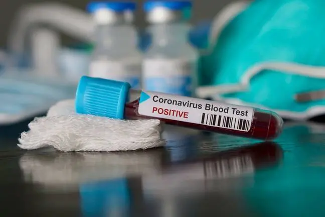 Positive blood test result for the new rapidly spreading Coronavirus, originating in Wuhan, China