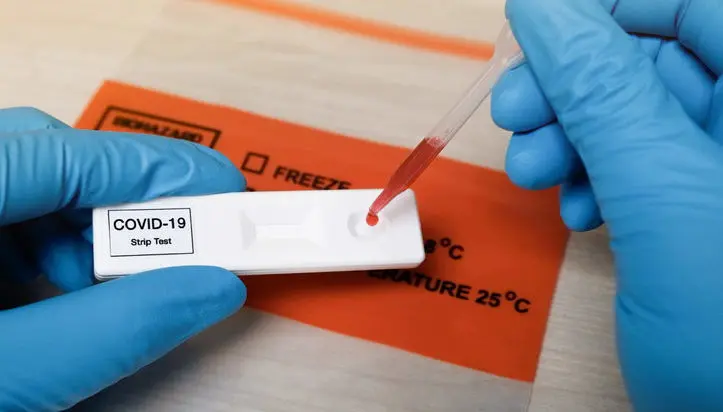 Rapid covid-19 strip Test