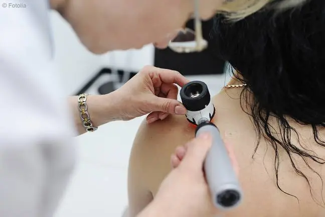 Doctor examining birthmarks and moles patient. examination of birthmarks and moles.the doctor examines the patient's mole