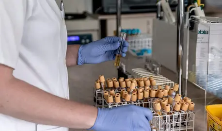 Muestras de laboratorio