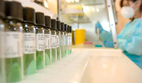 Pruebas de sarampión en laboratorio (Foto: Consejería de Salud)