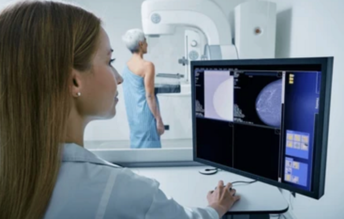 Una mamograf&iacute;a.