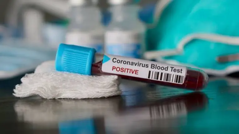 Positive blood test result for the new rapidly spreading Coronavirus, originating in Wuhan, China