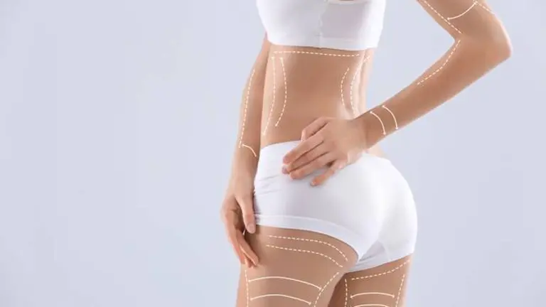 Young woman with marks for liposuction operation and space for text on light background. Cosmetic surgery