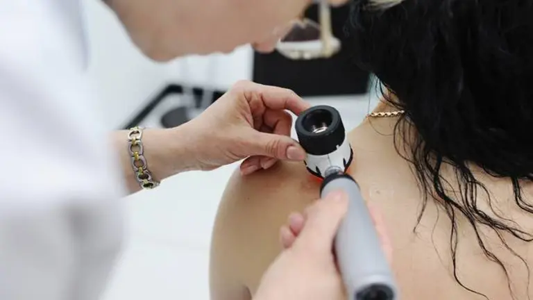 Doctor examining birthmarks and moles patient. examination of birthmarks and moles.the doctor examines the patient's mole