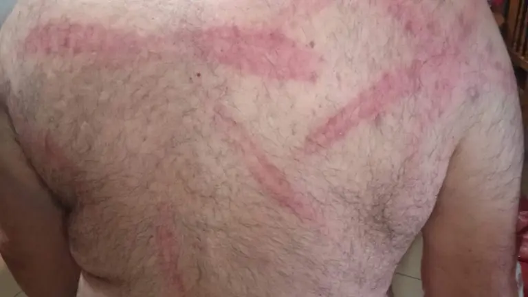 Imagen de la espalda del guarda tras la agresi&oacute;n con el bate de beisbol