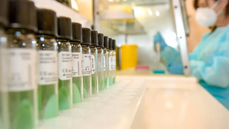 Pruebas de sarampi&oacute;n en laboratorio (Foto: Consejer&iacute;a de Salud)