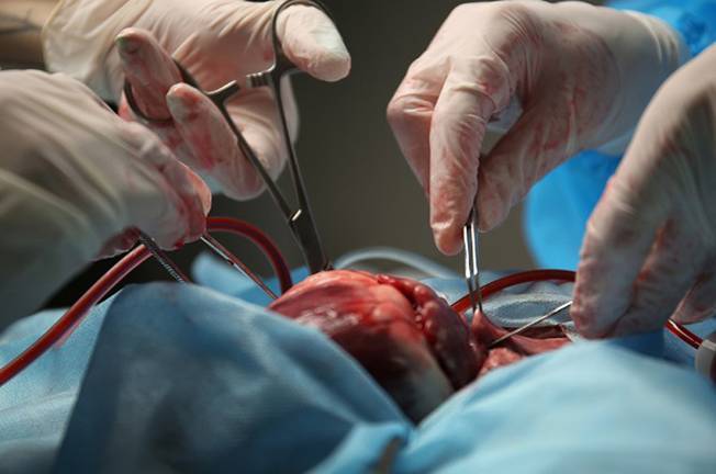 El 100% de las familias onubenses aceptaron donar órganos