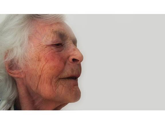 Las enfermedades neurodegenerativas, víctimas olvidadas de la Covid-19 4 Alzheimer
