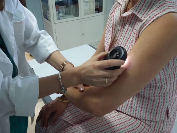 Cinco nuevos centros de salud dispondrán de teledermatología para el diagnóstico de cáncer de piel