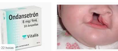 Alerta por un medicamento para embarazadas que provoca labio leporino a los niños
