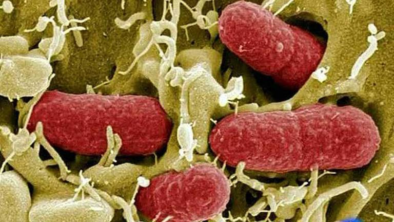 La bacteria E.coli y no la listeria causó la intoxicación masiva en Bollullos