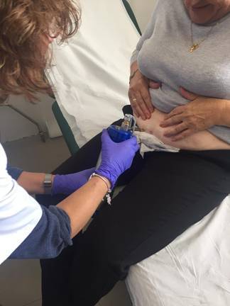 Centros de salud inician un programa de crioterapia para lesiones en la piel