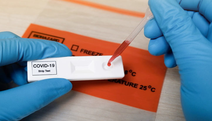 Los retrasos de Salud llevan a los pacientes a los laboratorios privados para descartar el Covid 1 Los retrasos de Salud llevan a los pacientes a los laboratorios privados para descartar el Covid