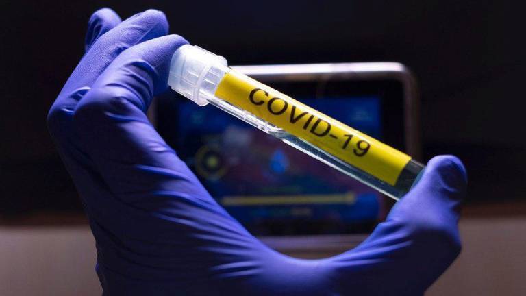 Huelva suma 79 nuevos positivos y 4 hospitalizaciones por Covid-19